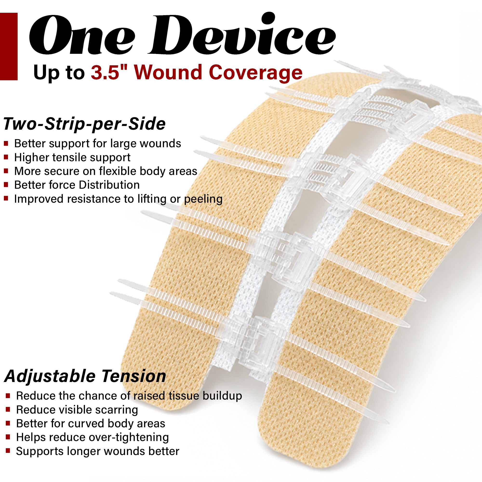 Wound Closure Kit