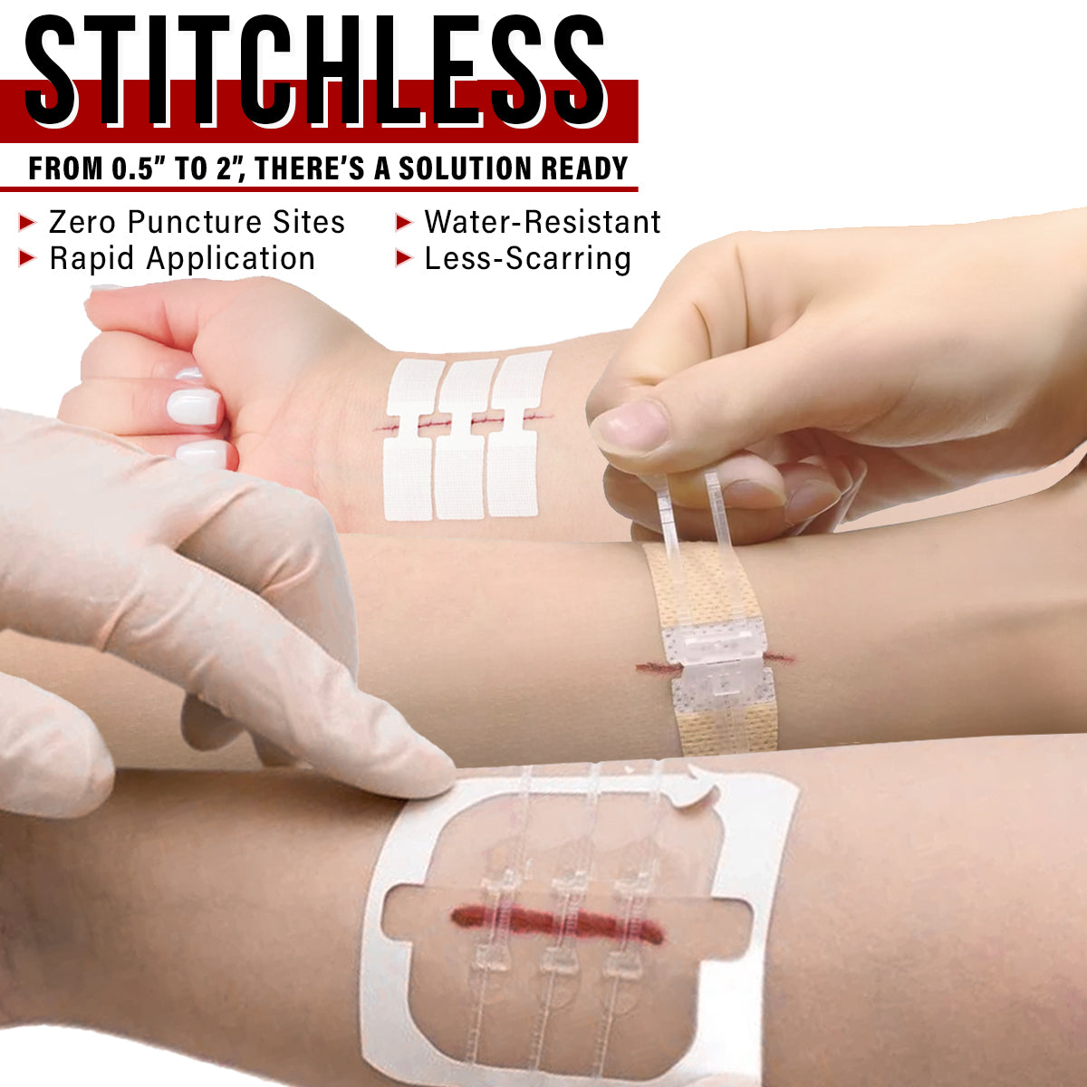Wound Closure Kit