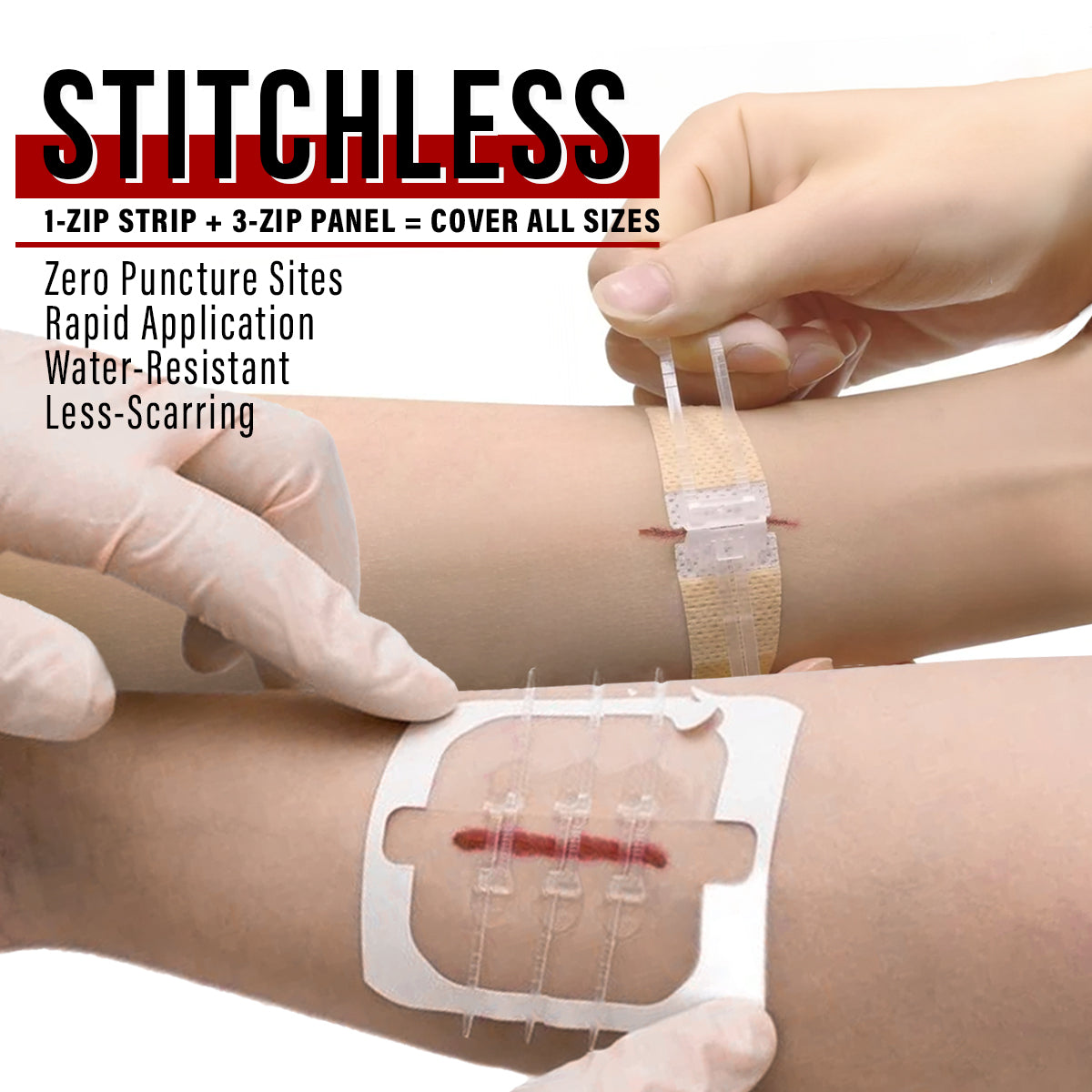 Wound Closure Kit